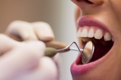 ¿Cada cuánto tiempo es necesario hacerse una limpieza dental?