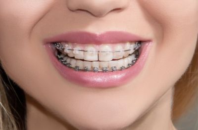 Dentista infantil: la primera visita y cómo perder el miedo