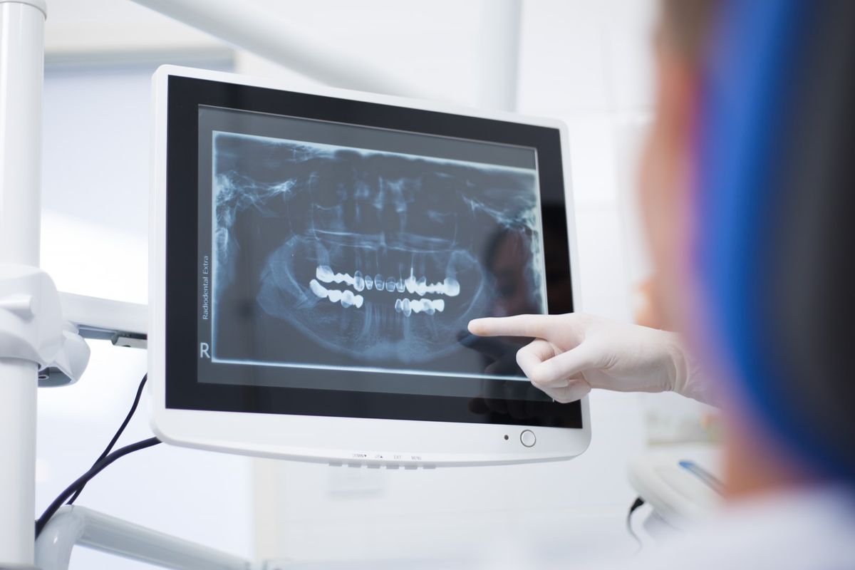 Radiografía intraoral