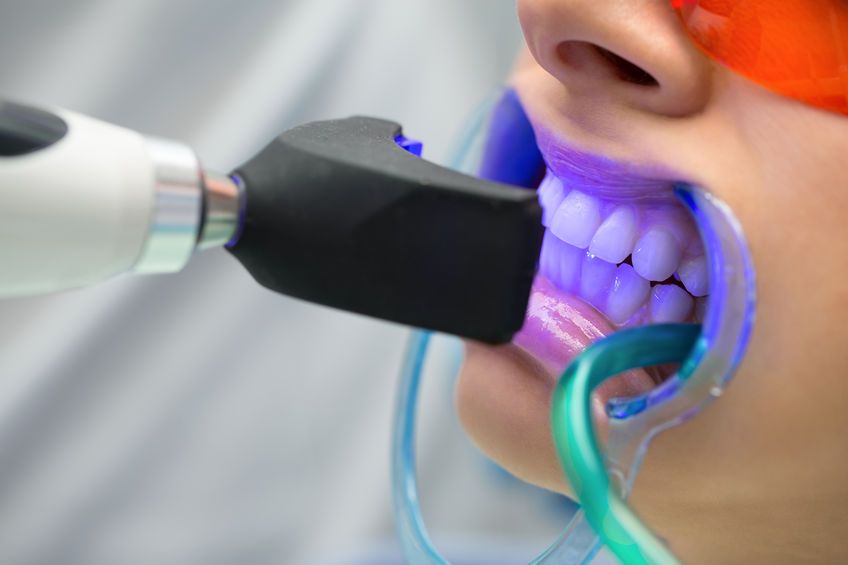 Blanqueamiento dental