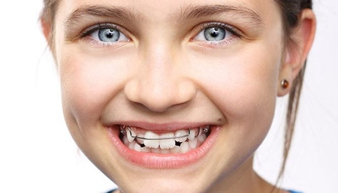 PADI: revisión dental infantil