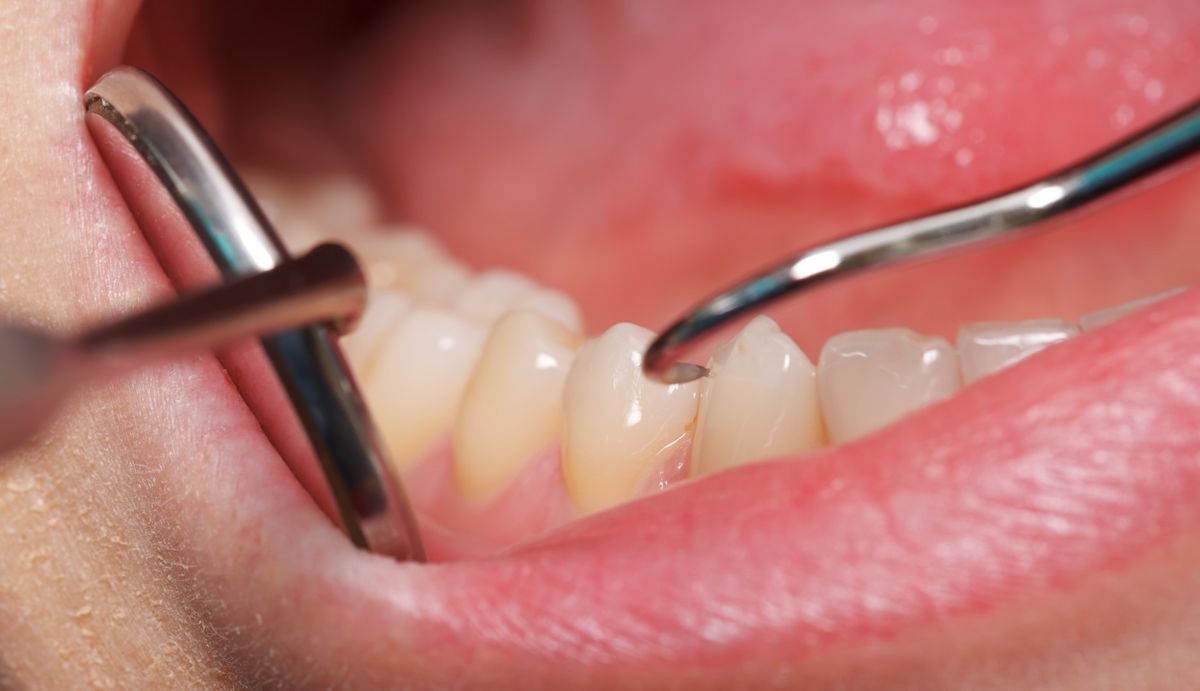 Periodoncia