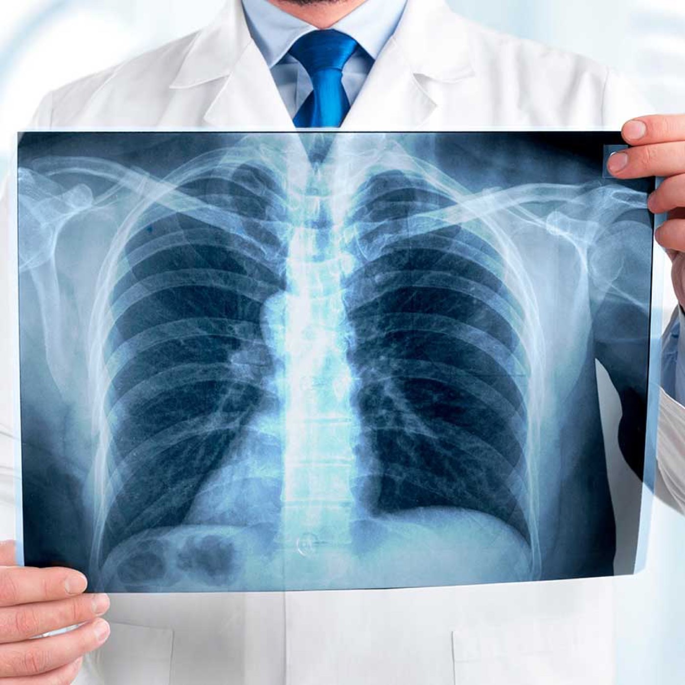 Radiología: diagnóstico por imagen